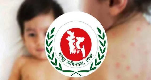 হাম ও হামের উপসর্গ নিয়ে একদিনে ৫ শিশুর মৃত্যু