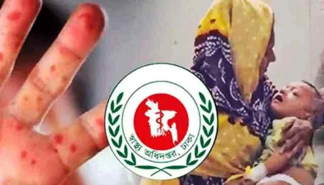 হামের উপসর্গ নিয়ে আরও ৫ শিশুর মৃত্যু